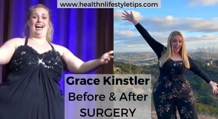 grace-kinstler-before-and-after-surgery