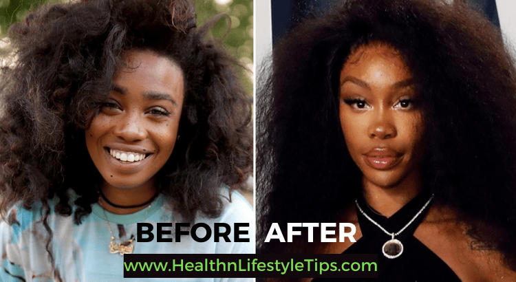 before-and-after-SZA-weight-loss