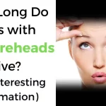 how-long-do-girls-with-big-foreheads-live-for