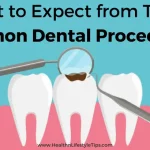 most-common-dental-procedures