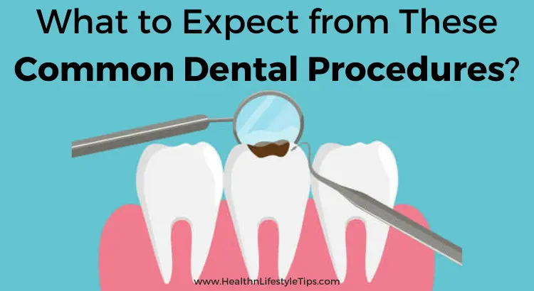 most-common-dental-procedures